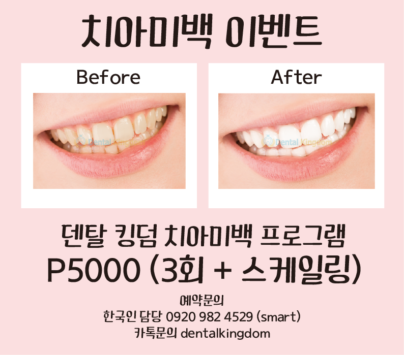 퀘존 덴탈 킹덤